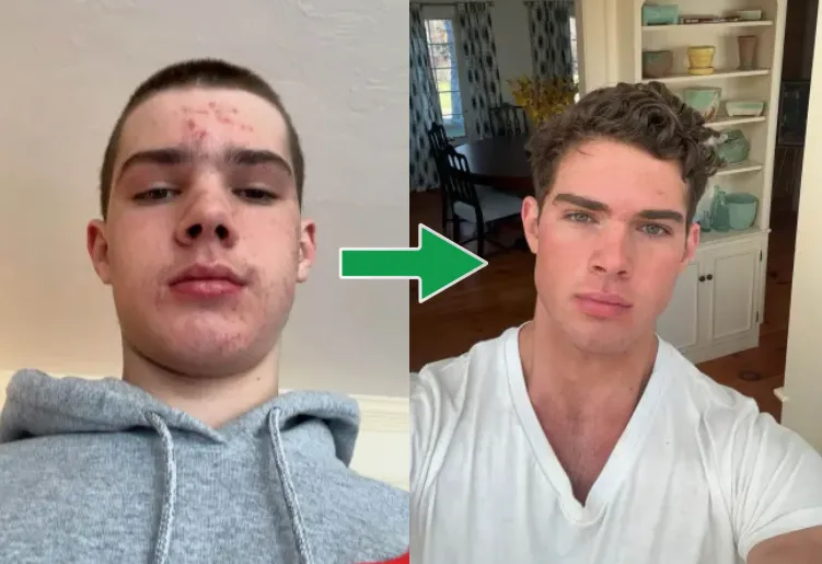 clavicular arrested — US news